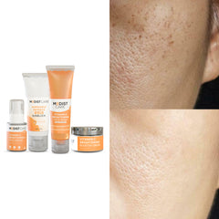 Complete Skin Brightening Bundle | Face Wash 100ml + Serum 30ml + Cream 50ml + Sunblock SPF 40 50ml