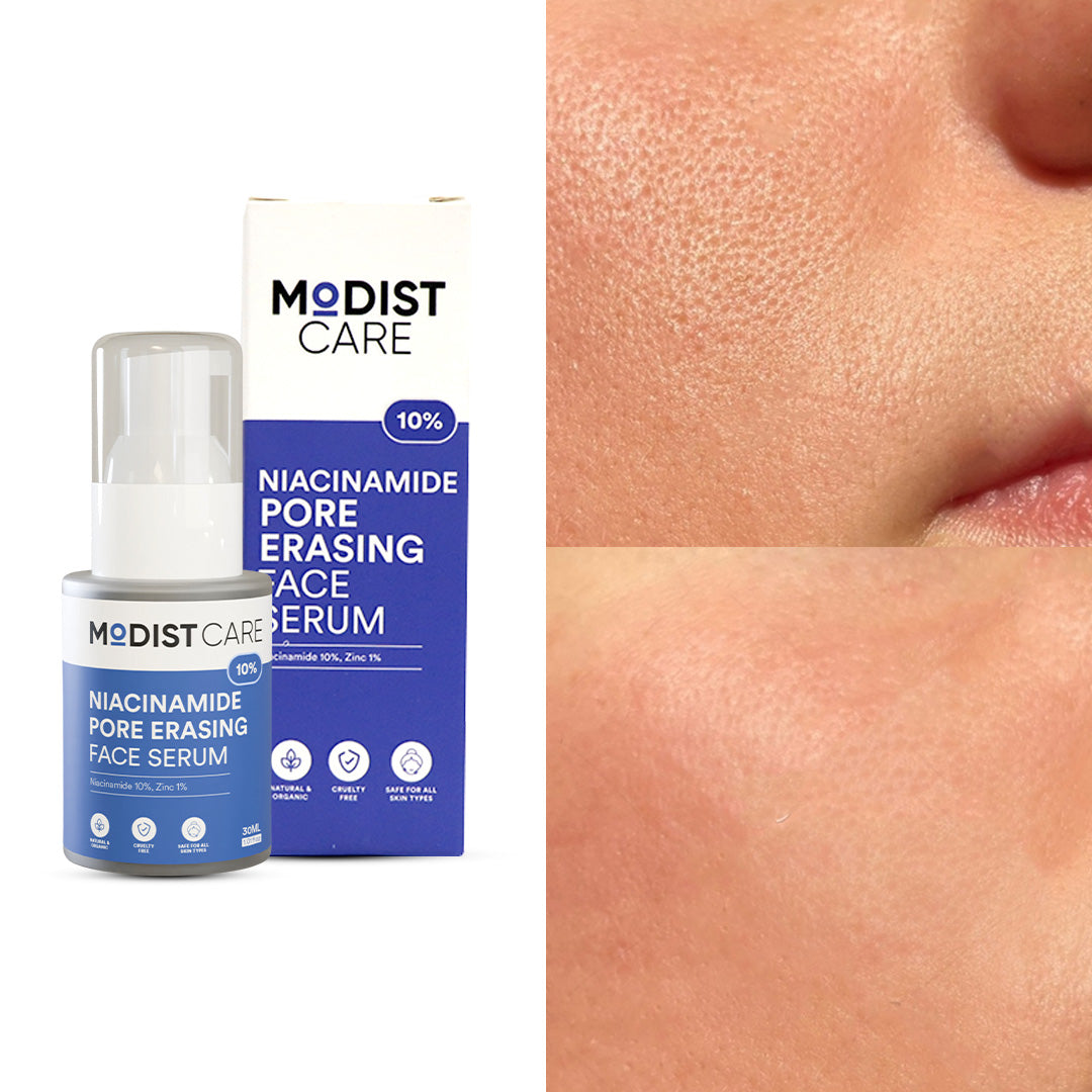 10% Niacinamide Pore Erasing Face Serum - 30ml with Niacinamide 10% & Zinc 1%